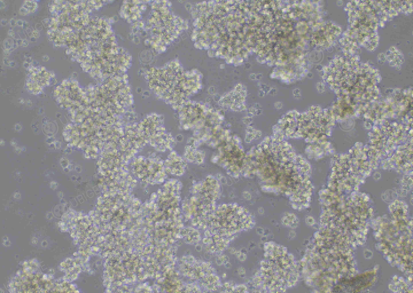 Cell image of the NK-92 cells with gene knockout by Ubigene