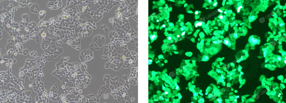 Lentivirus-transduced HeLa Cells