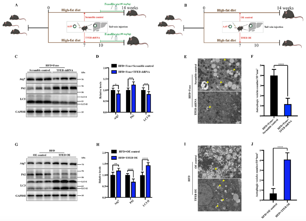 Fenofibrate induces autophagy in NAFLD mouse livers through TFEB