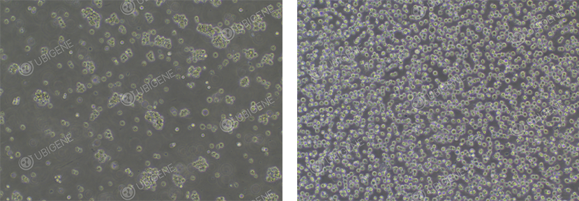 Jurkat Cell Image (Normal Growth)