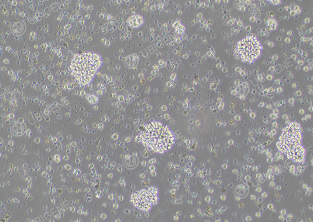 Many cell debris and dead cells observed