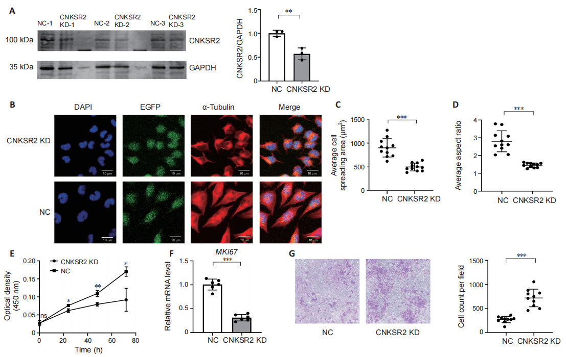 CNKSR2 Gene Knockdown Interferes with Centrosome-Related Functions