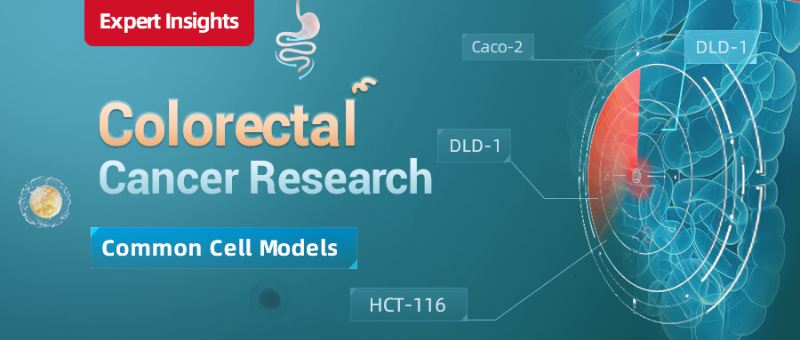 Understanding on Common Cell Models for Colorectal Cancer Research