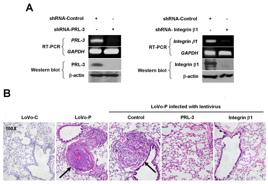 Depletion of integrin β1 or PRL-3 eliminates the promoting effect of PRL-3 on metastasis in vivo.