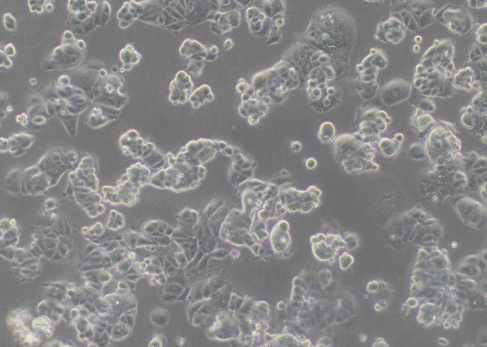 Lentiviral transduction of MCF7 (100×)