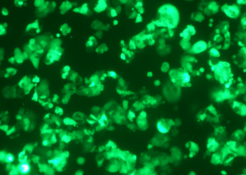 Lentiviral transduction of MCF7 (100×)