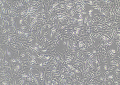 Lentivirus Infection of MDA-MB-231 Cells