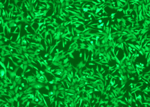 Lentivirus Infection of MDA-MB-231 Cells