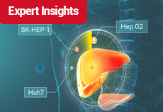 Expert Insights | Cell Models Commonly Used in Liver Cancer Research