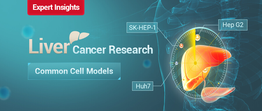 Cell Models Commonly Used in Liver Cancer Research