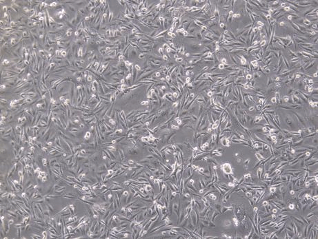 Normal MDA-MB-231 cells