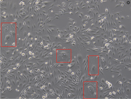 Poor growth status of MDA-MB-231 cells