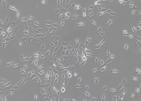 Poor growth status of MDA-MB-231 cells