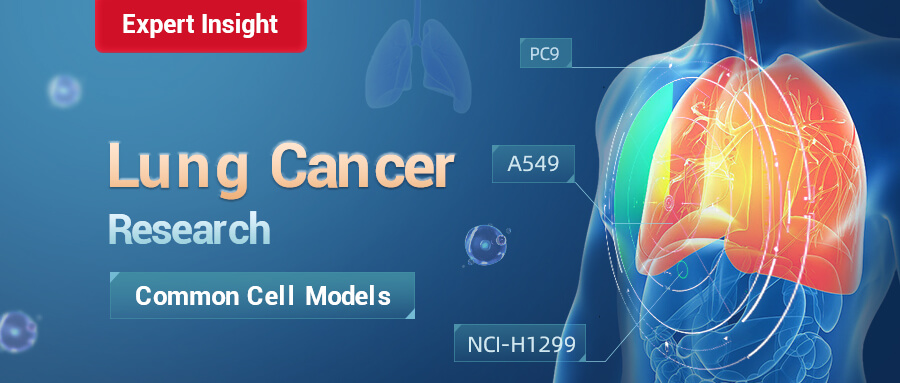 Common Cell Models Used in Lung Cancer Research