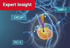 What are the commonly used cell lines for prostate cancer research?