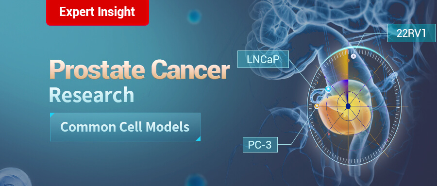 the commonly used cell lines for prostate cancer research