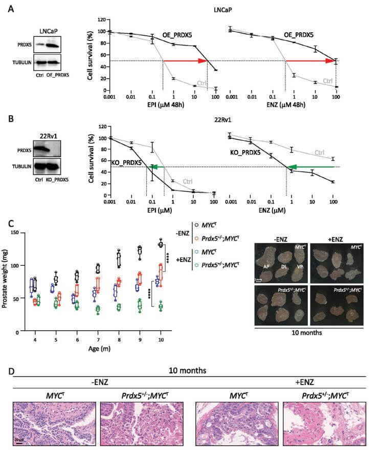 The Key Role of PRDX5 in AR Inhibitor Resistance and CRPC Progression