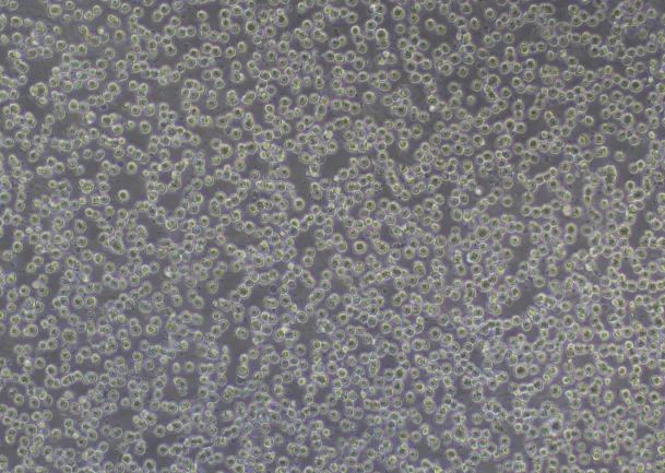 RAW 264.7 Cell Image (Normal Growth) RAW 264.7 Cell Image (Normal Growth)