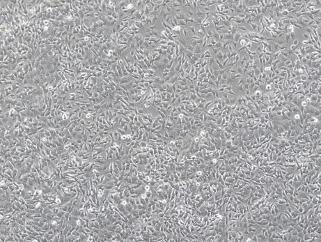 normal growth sh-sy5y cell right