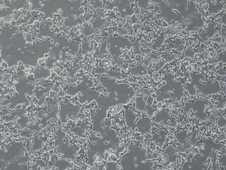 poor growth sh-sy5y cell right