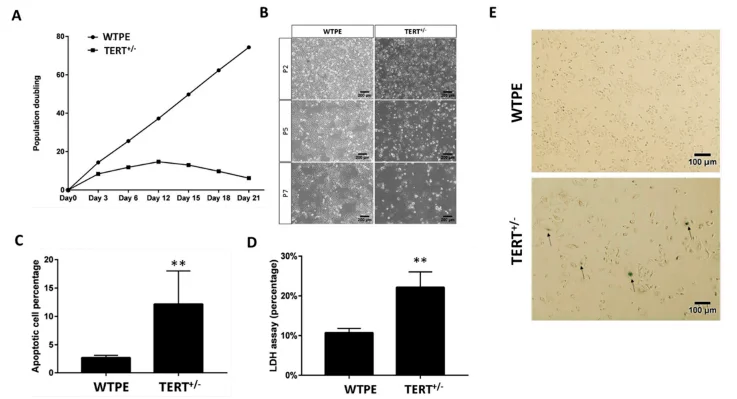 CRISPR/Cas9 mediated TERT disruption can suppress tumor cell survival