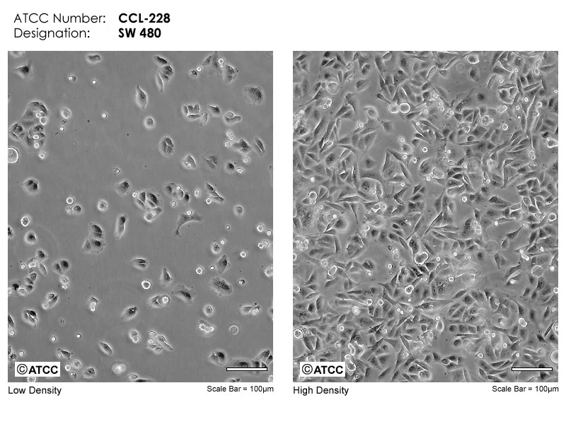sw480 cells in atcc