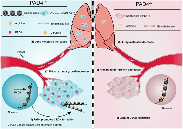 Overview of PAD4 mediated Lung metastasis